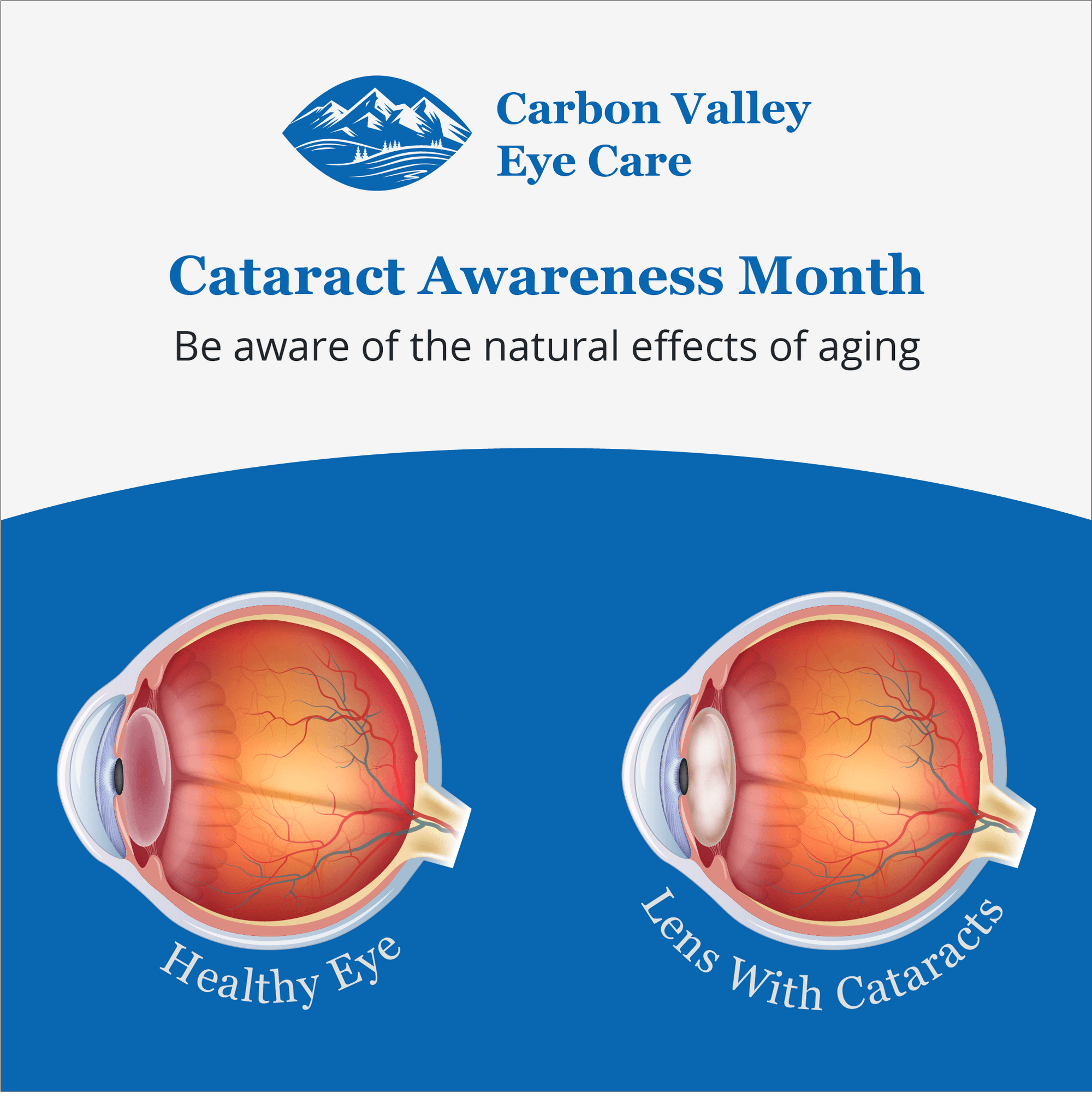 Carbon Valley Eye Care